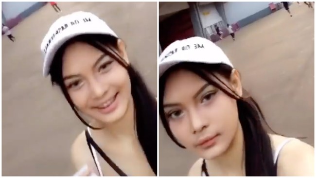 Array,Perbedaan Wajah Erika Carlina Sebelum & Sesudah Operasi, Disebut Beda Banget