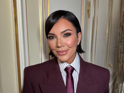 Kris Jenner Tampil 10 Tahun Lebih Muda dengan Wajah Baru, Oplas Rp 2 Miliar