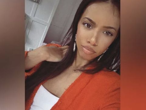 Kisah Sedih Wanita yang Di-Bully Bau Seperti Tinja, Punya Kondisi Langka